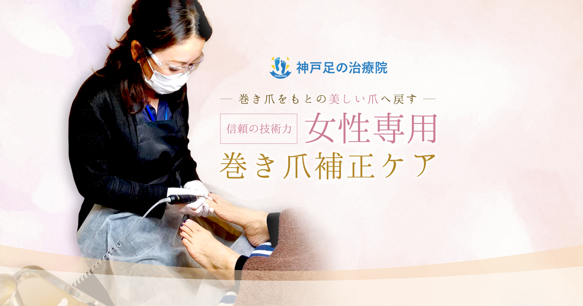 ペディグラス巻き爪補正スクール | 神戸の巻き爪治療専門店｜神戸足の
