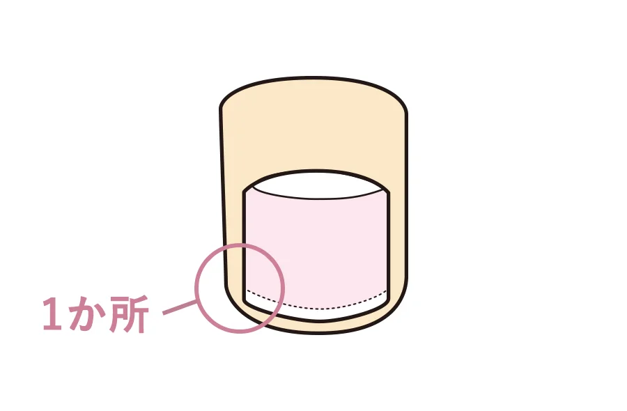 How to count one ingrown toenail point