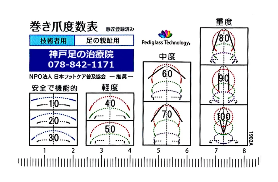 Ingrown toenail severity chart