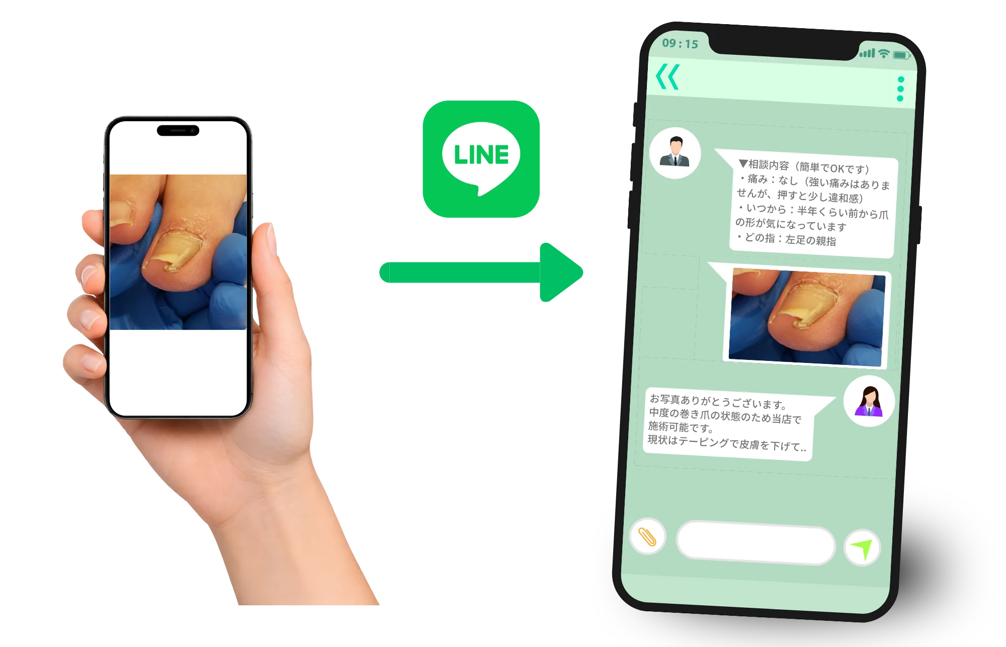 How to consult by sending nail photos on LINE